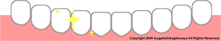 ���ȋZ�H�������T���̕��́A�Ê_���ȋZ�H��